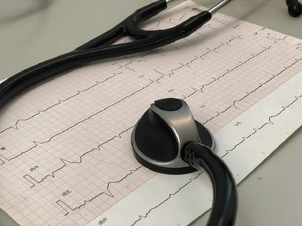 Na czym właściwie polega badanie EKG?